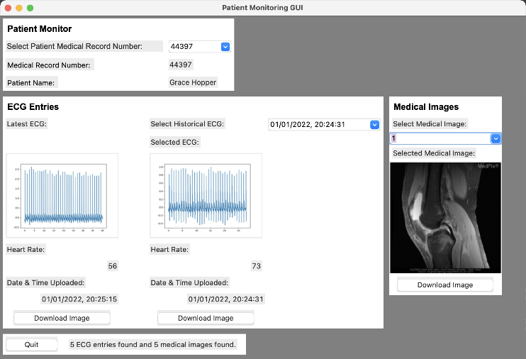 Patient Monitoring System GUI screenshot